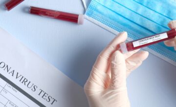 Test Coronavirus