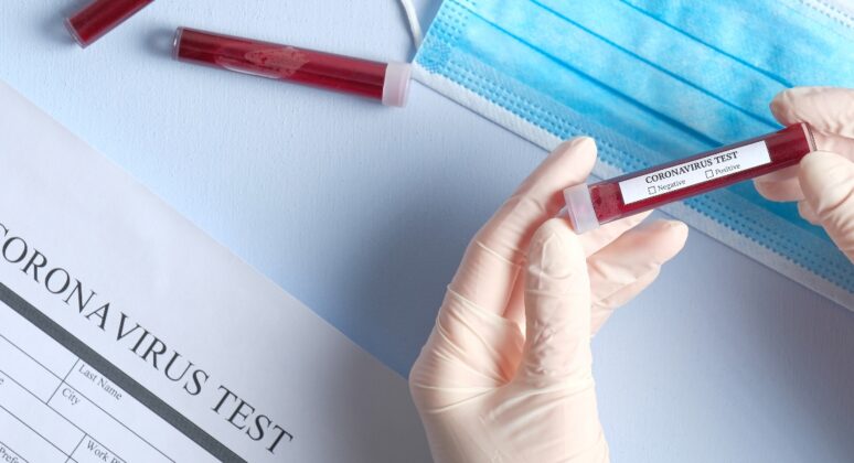 Test Coronavirus